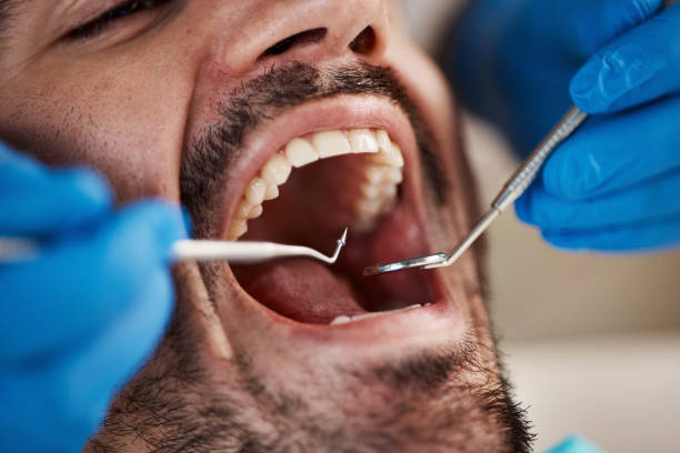 Best Dental Inlays and Onlays  in New Burlington, OH